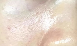 麻豆儿毛周角化修复霜,焕肤新选择，告别粗糙肌肤